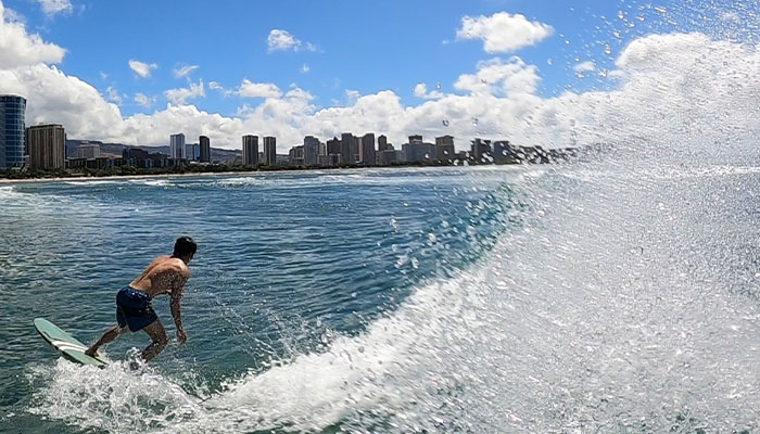 予防歯科の重要性